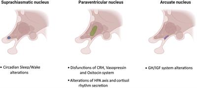 Hypothalamus and amyotrophic lateral sclerosis: potential implications in sleep disorders